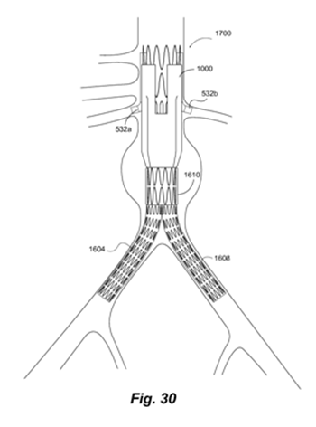 NK Patent Law – Mobile app patent illustration (U.S. Patent No. 9,427,306)